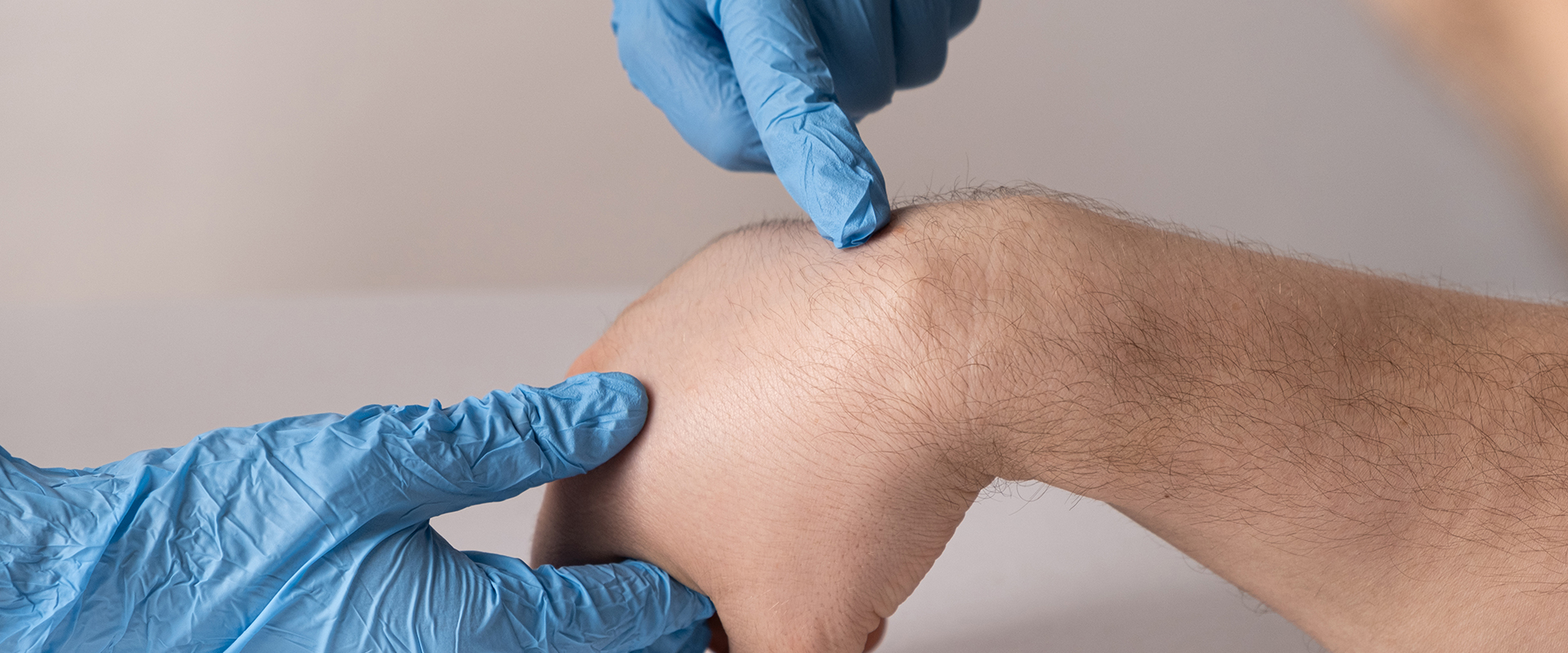 Hände mit blauen Latexhandschuhen untersuchen eine andere Hand
