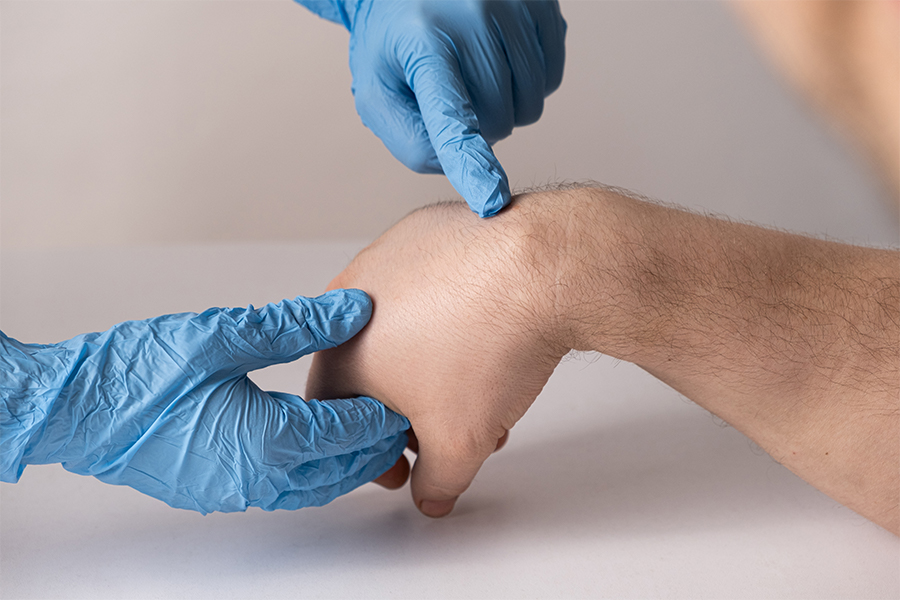 Hände mit blauen Latexhandschuhen untersuchen eine andere Hand